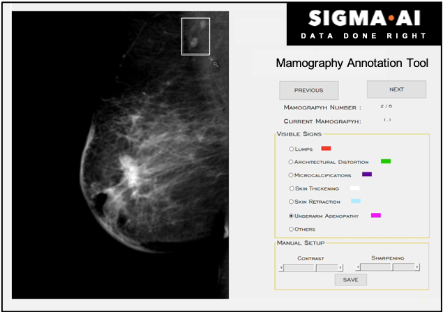 Mammography_2